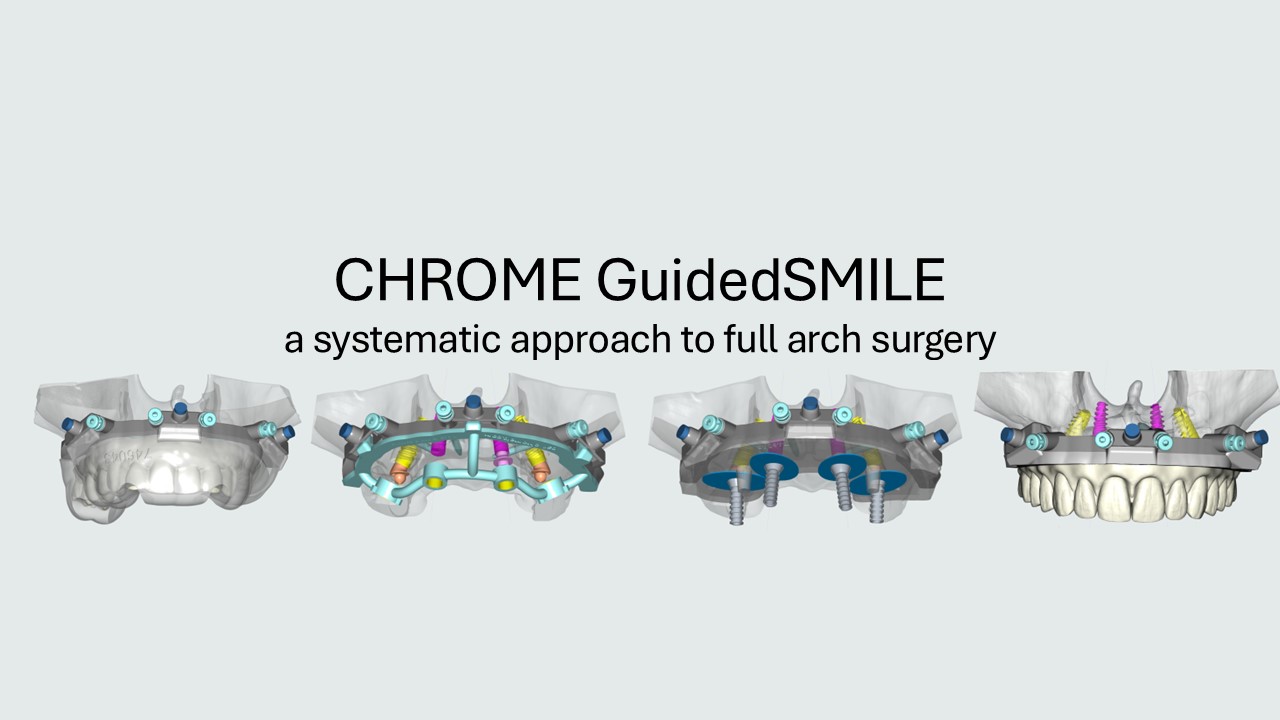 CHROME GuidedSMILE full arch guided workflow overview