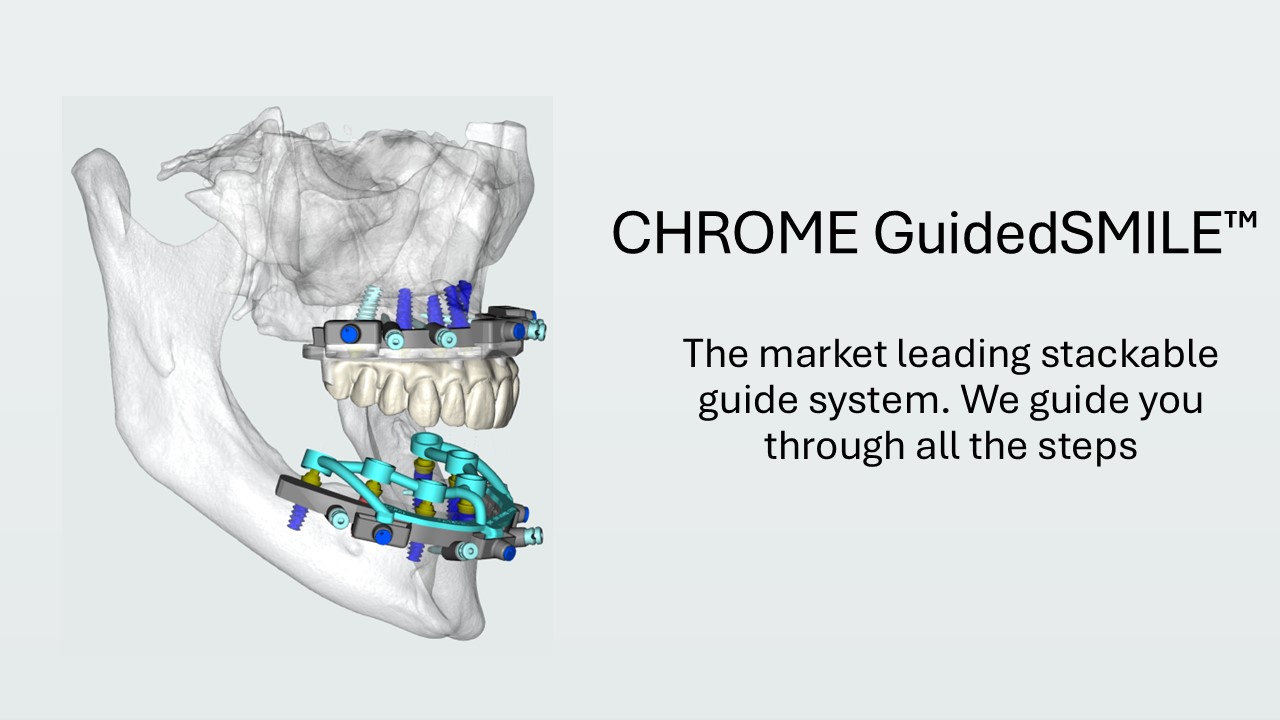 CHROME GuidedSMILE stackable metal guide system