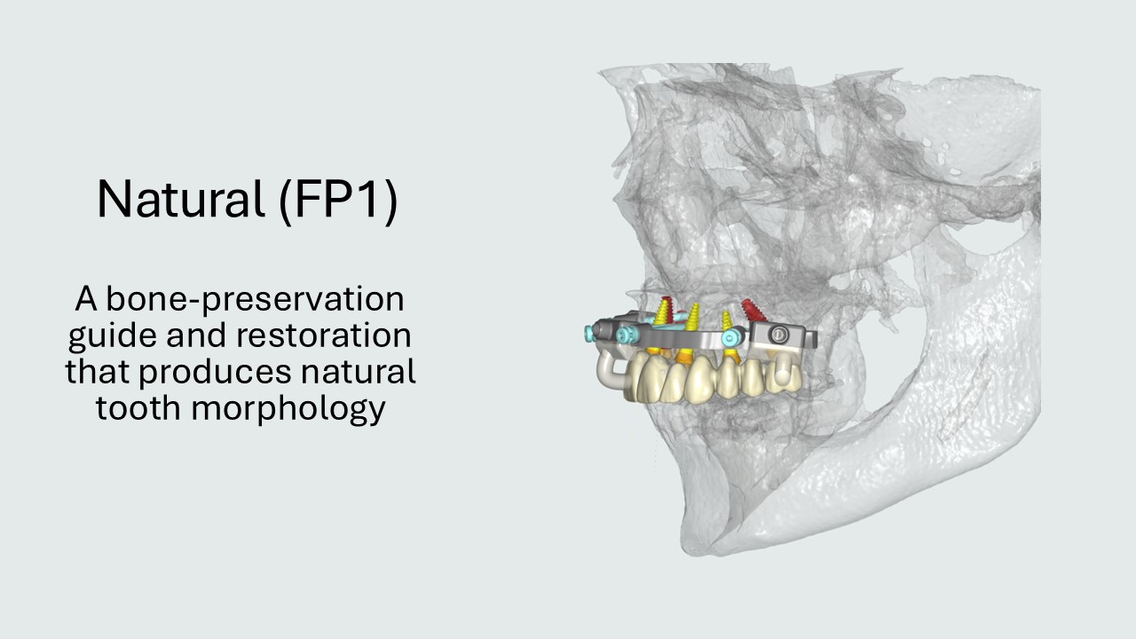 Natural FP1 restoration with natural tooth morphology