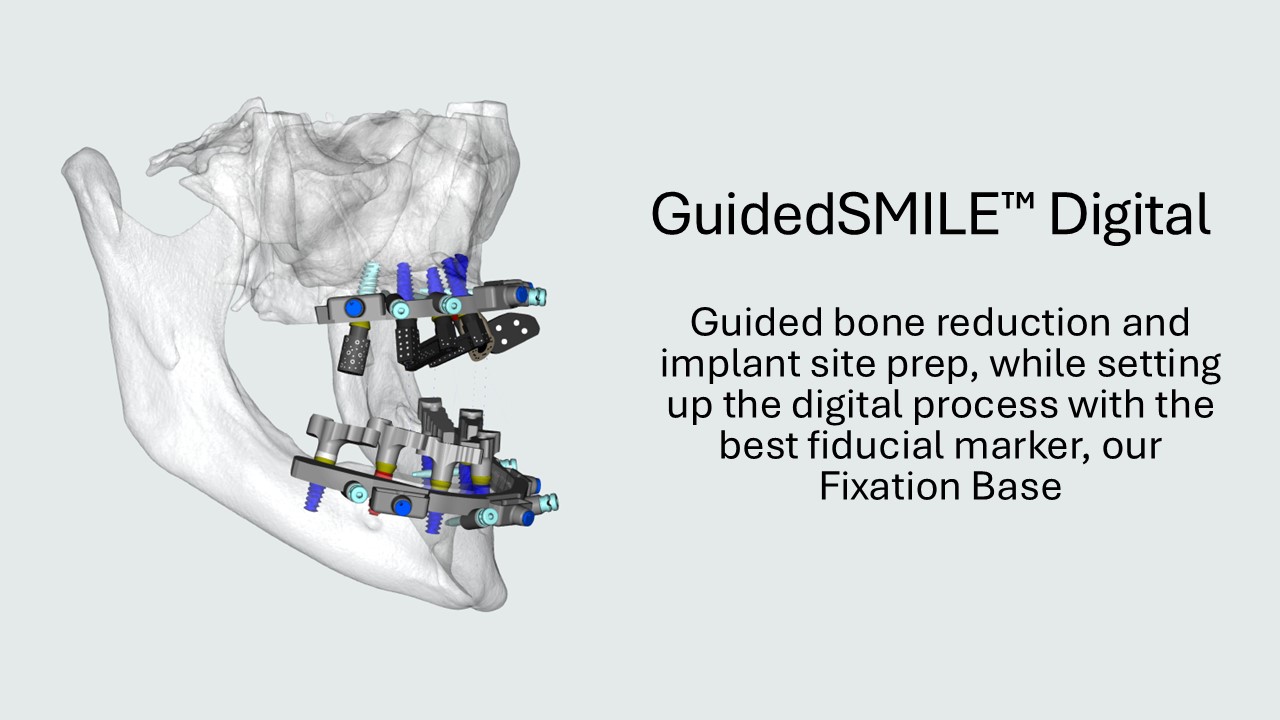 Guided bone reduction referenced to the metal fixation base