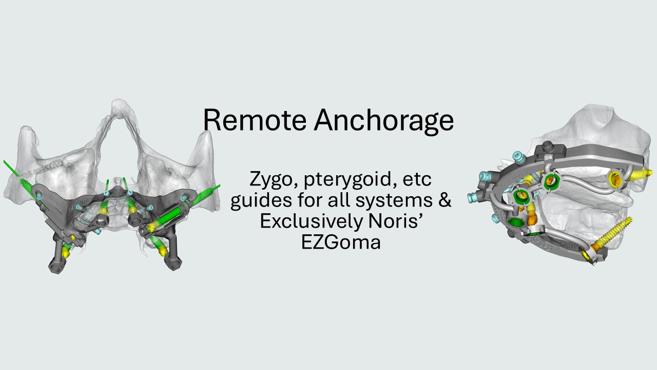 Zygomatic and pterygoid remote anchorage guides